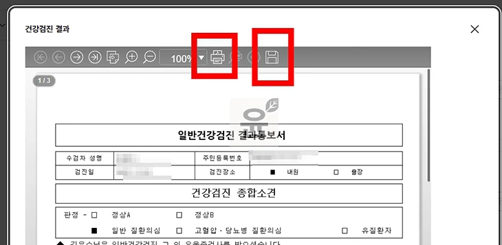 국민건강검진 결과 조회 모바일로 확인하고 다운로드하는 방법